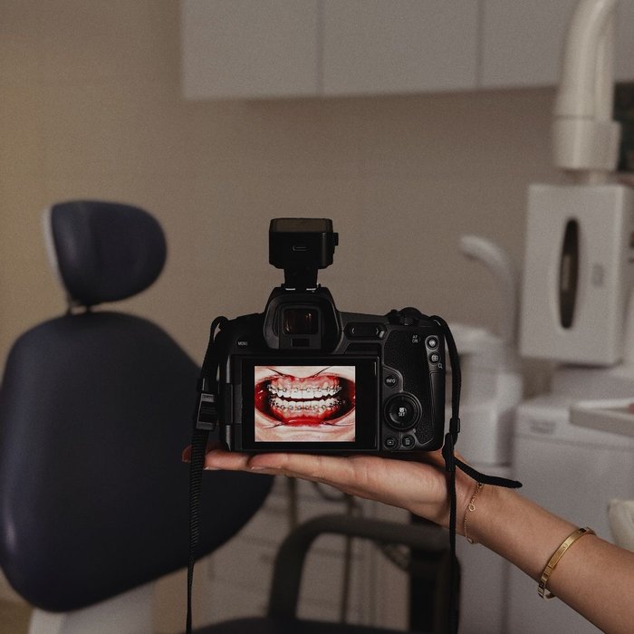 Reviewing a patient's smile on camera at 32Carrat